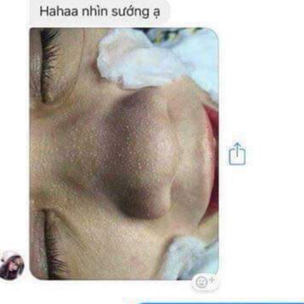 OHIO Hangul Byebye Blackheads